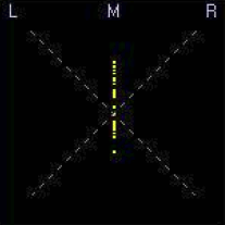 Señal de audio Mono